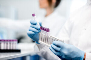 A woman in a white lab coat stands in the background, blurred; in the foreground, hands in blue latex gloves place a new test tube into a test tube rack.