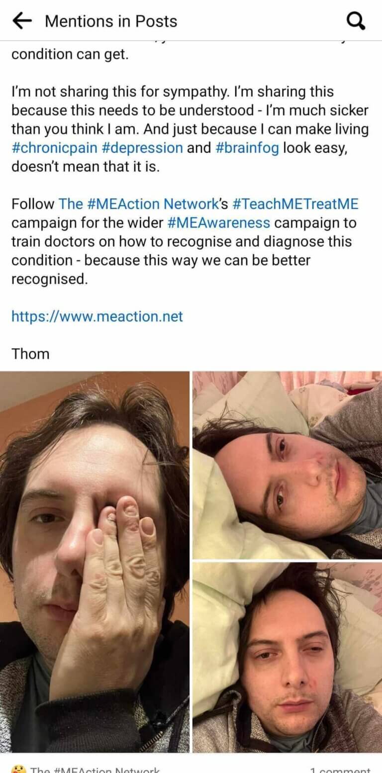 screenshot of a post that features a man in 3 photos: 1 covering his face and 2 laying down on a pillow